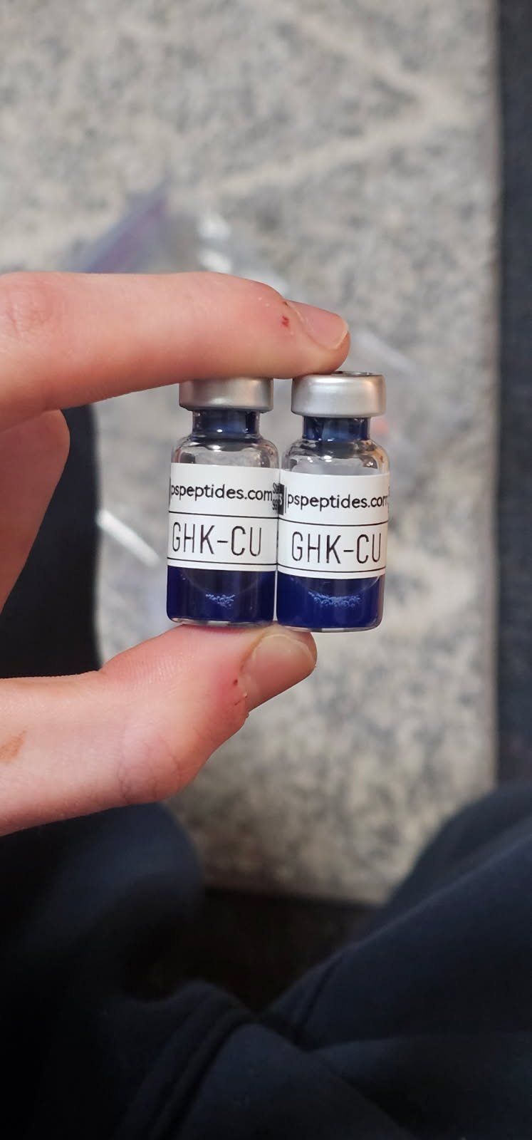 Customer review photo